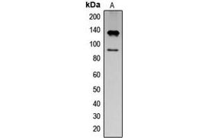 Western blot analysis of IFNAR1 (pY466) expression in K562 EGF-treated (A) whole cell lysates. (IFNAR1 antibody  (C-Term, pTyr466))