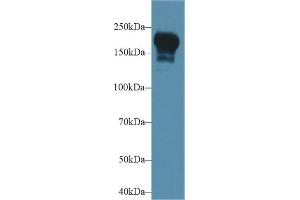 Western Blotting (WB) image for anti-Phosphatidylinositol-4-Phosphate 3-Kinase, Catalytic Subunit Type 2 beta (PIK3C2B) (AA 790-1025) antibody (ABIN7439555)