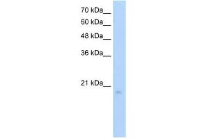 WB Suggested Anti-RGS8 Antibody Titration:  5. (RGS8 antibody  (N-Term))