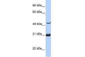 WB Suggested Anti-NUP35 Antibody Titration: 0. (NUP35 antibody  (C-Term))