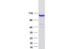 Dynamin 2 (DNM2) (Transcript Variant 3) protein (Myc-DYKDDDDK Tag)