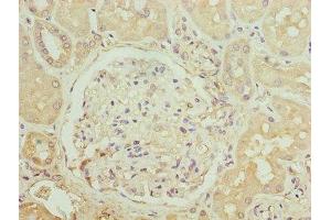 Immunohistochemistry of paraffin-embedded human kidney tissue using ABIN7145914 at dilution of 1:100 (CCR1 antibody  (AA 306-355))