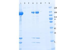 SDS-PAGE of Anti-DYKDDDDK  Affinity Gel. (DYKDDDDK Tag antibody)