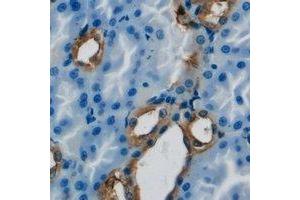 Immunohistochemical analysis of PIMT staining in human kidney formalin fixed paraffin embedded tissue section. (PCMT1 antibody)