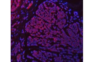 IF analysis of SETD3 using anti-SETD3 antibody (ABIN7600293). (SETD3 antibody  (AA 173-468))
