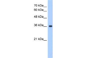 WB Suggested Anti-ELOVL7 Antibody Titration:  1. (ELOVL7 antibody  (N-Term))