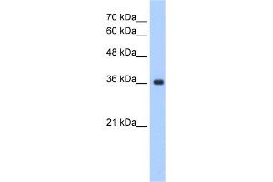 ELOVL7 antibody  (N-Term)