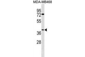 Western Blotting (WB) image for anti-Abhydrolase Domain Containing 1 (ABHD1) antibody (ABIN3000271) (ABHD1 antibody)