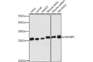 Western blot analysis of extracts of various cell lines, using R Rabbit pAb (ABIN7269841) at 1:2000 dilution. (RANBP1 antibody  (AA 1-100))
