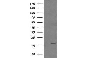 Image no. 2 for anti-Cancer/testis Antigen 1B (CTAG1B) antibody (ABIN1499890) (CTAG1B antibody)