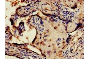 Immunohistochemistry of paraffin-embedded human placenta tissue using ABIN7148675 at dilution of 1:100 (CRTC1 antibody  (AA 1-248))