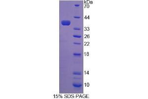 Image no. 1 for CoA Synthase (COASY) (AA 101-366) protein (His tag) (ABIN6239626) (COASY Protein (AA 101-366) (His tag))