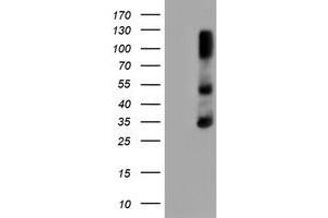 HEK293T cells were transfected with the pCMV6-ENTRY control (Left lane) or pCMV6-ENTRY ERCC1 (Right lane) cDNA for 48 hrs and lysed. (ERCC1 antibody)