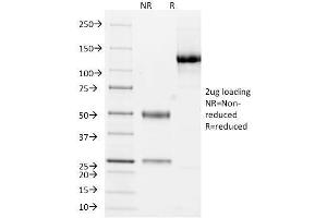SDS-PAGE Analysis Purified Cytokeratin 10/13 Monoclonal Antibody (DE-K13). (KRT10, KRT13 antibody)