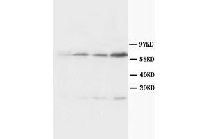 Western Blotting (WB) image for anti-Bridging Integrator 1 (BIN1) (AA 189-398) antibody (ABIN1105531)