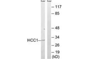 Western blot analysis of extracts from mouse liver cells, using HCC1 Antibody. (RBM39 antibody  (AA 147-196))