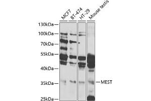 Western blot analysis of extracts of various cell lines, using MEST antibody (ABIN6133292, ABIN6143749, ABIN6143751 and ABIN6222673) at 1:1000 dilution.