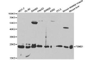 Western blot analysis of extracts of various cell lines, using PSMB1 antibody. (PSMB1 antibody  (AA 29-241))