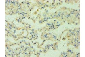 Immunohistochemistry of paraffin-embedded human lung tissue using ABIN7168147 at dilution 1:100 (RRM2B antibody  (AA 1-351))