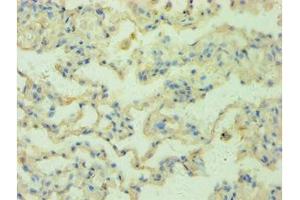 Immunohistochemistry of paraffin-embedded human lung tissue using ABIN7168147 at dilution 1:100