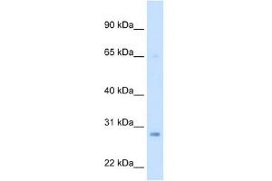 ECHS1 antibody used at 2. (ECHS1 antibody  (Middle Region))
