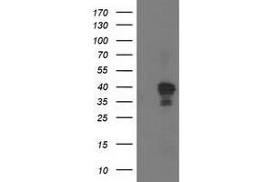 Western Blotting (WB) image for anti-NudE Nuclear Distribution E Homolog (A. Nidulans)-Like 1 (NDEL1) antibody (ABIN1499854)