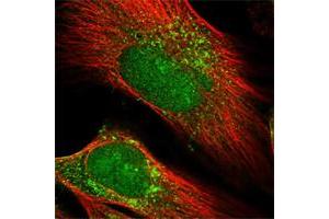 Immunofluorescent staining of human cell line U-251 MG shows positivity in nucleus & vesicles. (PRUNE2 antibody)