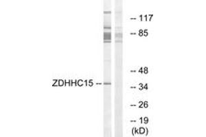 Western blot analysis of extracts from Jurkat cells, using ZDHHC15 Antibody. (ZDHHC15 antibody  (AA 288-337))