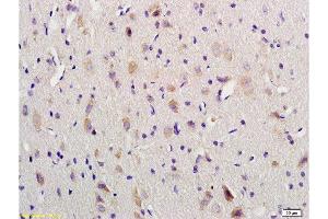 Formalin-fixed and paraffin embedded rat brain labeled with Anti-VIP Polyclonal Antibody, Unconjugated  1:200 followed by conjugation to the secondary antibody and DAB staining