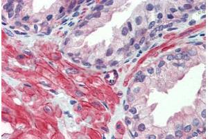 Human Prostate: Formalin-Fixed, Paraffin-Embedded (FFPE) (HTR2C antibody  (AA 387-446))