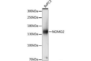 Western blot analysis of extracts of BxPC3 cells using NOMO2 Polyclonal Antibody at dilution of 1:1000. (NOMO2 antibody)
