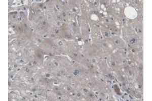 Detection of CNPY2 in Human Liver Tissue using Polyclonal Antibody to Canopy 2 Homolog (CNPY2)