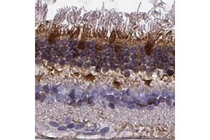 Immunohistochemical staining of human retina shows strong cytoplasmic positivity in photoreceptor layer and outer plexiform layer.