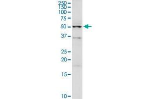 UGP2 MaxPab rabbit polyclonal antibody. (UGP2 antibody  (AA 1-508))