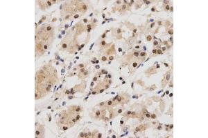 Immunohistochemistry of paraffin-embedded human stomach using KPNA4 Antibody (ABIN5971058) at dilution of 1/200 (40x lens). (KPNA4 antibody)