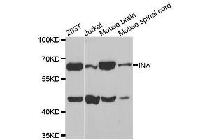 Western blot analysis of extracts of various cell lines, using INA antibody. (INA antibody)