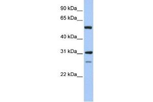 IMPDH1 antibody used at 1 ug/ml to detect target protein. (IMPDH1 antibody)