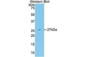 Western blot analysis of the recombinant protein. (Neuregulin 1 antibody  (AA 20-242))