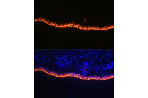 Immunofluorescence analysis of rat skin using Cytokeratin 10 Rabbit mAb (ABIN1679404, ABIN3019133, ABIN3019134 and ABIN7101721) at dilution of 1:100 (40x lens). (Keratin 10 antibody)
