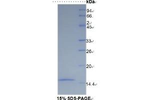 SDS-PAGE of Protein Standard from the Kit (Highly purified E. (SLC30A8 ELISA Kit)