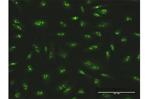 Immunofluorescence of purified MaxPab antibody to SMARCA5 on HeLa cell. (SMARCA5 antibody  (AA 1-1052))