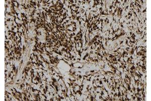 ABIN6276940 at 1/100 staining Human gastric tissue by IHC-P. (LIG3 antibody  (Internal Region))