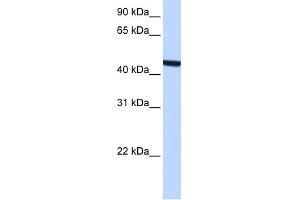 WB Suggested Anti-ZCCHC3 Antibody Titration:  0. (ZCCHC3 antibody  (Middle Region))