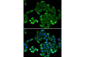 Immunofluorescence analysis of MCF-7 cells using PTS antibody (ABIN5973727). (PTS antibody)