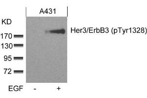 Western blot analysis of extracts from A431 cells untreated or treated with EGF using Her3/ErbB3(phospho-Tyr1328) Antibody. (ERBB3 antibody  (pTyr1328))