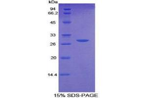 SDS-PAGE (SDS) image for CD36 (CD36) (AA 91-311) protein (His tag,T7 tag) (ABIN1879480)