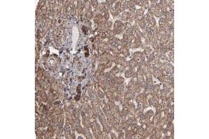 Immunohistochemical staining (Formalin-fixed paraffin-embedded sections) of human liver with ITGB5 polyclonal antibody  shows strong cytoplasmic positivity in bile duct cells at 1:50-1:200 dilution. (Integrin beta 5 antibody)