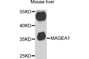 Western blot analysis of extracts of mouse liver, using MAGEA1 antibody (ABIN5973183) at 1/1000 dilution. (MAGEA1 antibody)