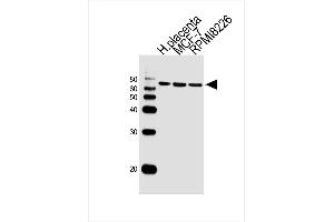 Lane 1: Sample Tissue/Cell lysates, Lane 2: Sample Tissue/Cell lysates, Lane 3: Sample Tissue/Cell lysates, probed with antibodyname Monoclonal Antibody, unconjugated (bsm-51388M) at 1:1000 overnight at 4°C followed by a conjugated secondary antibody for 60 minutes at 37°C. (RPS6KB2 antibody)