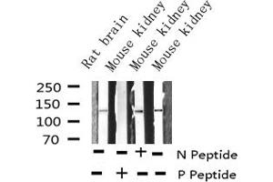 Western blot analysis of Phospho-FAK (Tyr861) expression in various lysates (FAK antibody  (pTyr861))